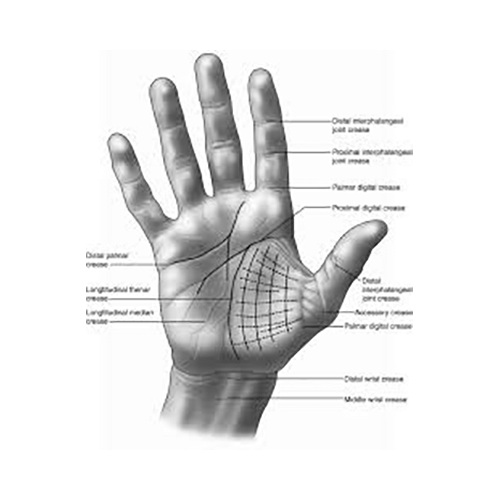 Dyna 1688 Knuckle Bender Splint Large - Image 3
