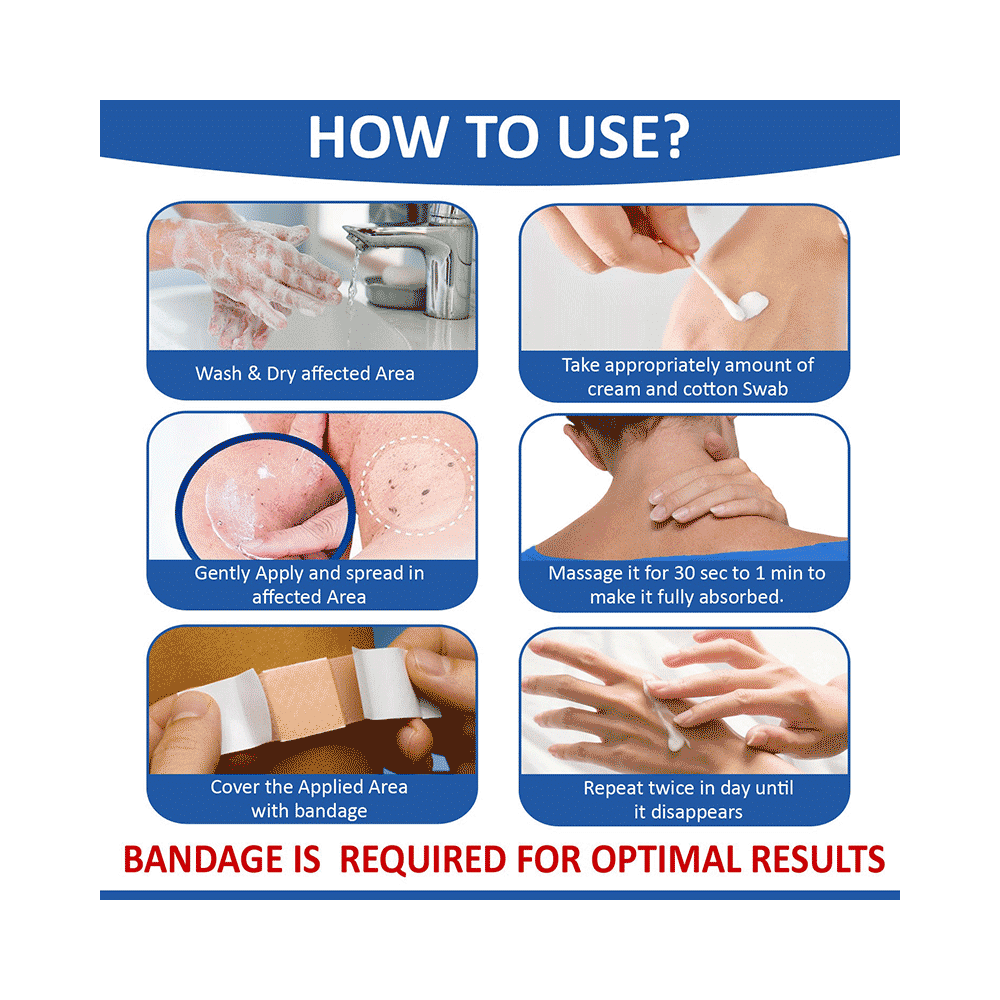 7Days Wart Remover Cream - Image 9