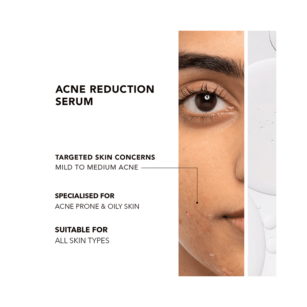 Novology 0.1% Thymol + Terpineol Acne Reduction Serum - Image 8
