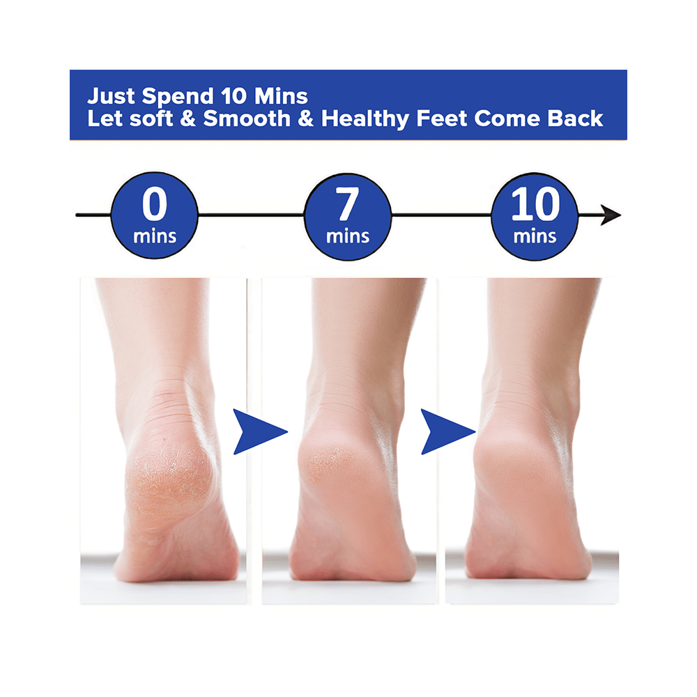 Dr Foot File Callus Remover - Image 6