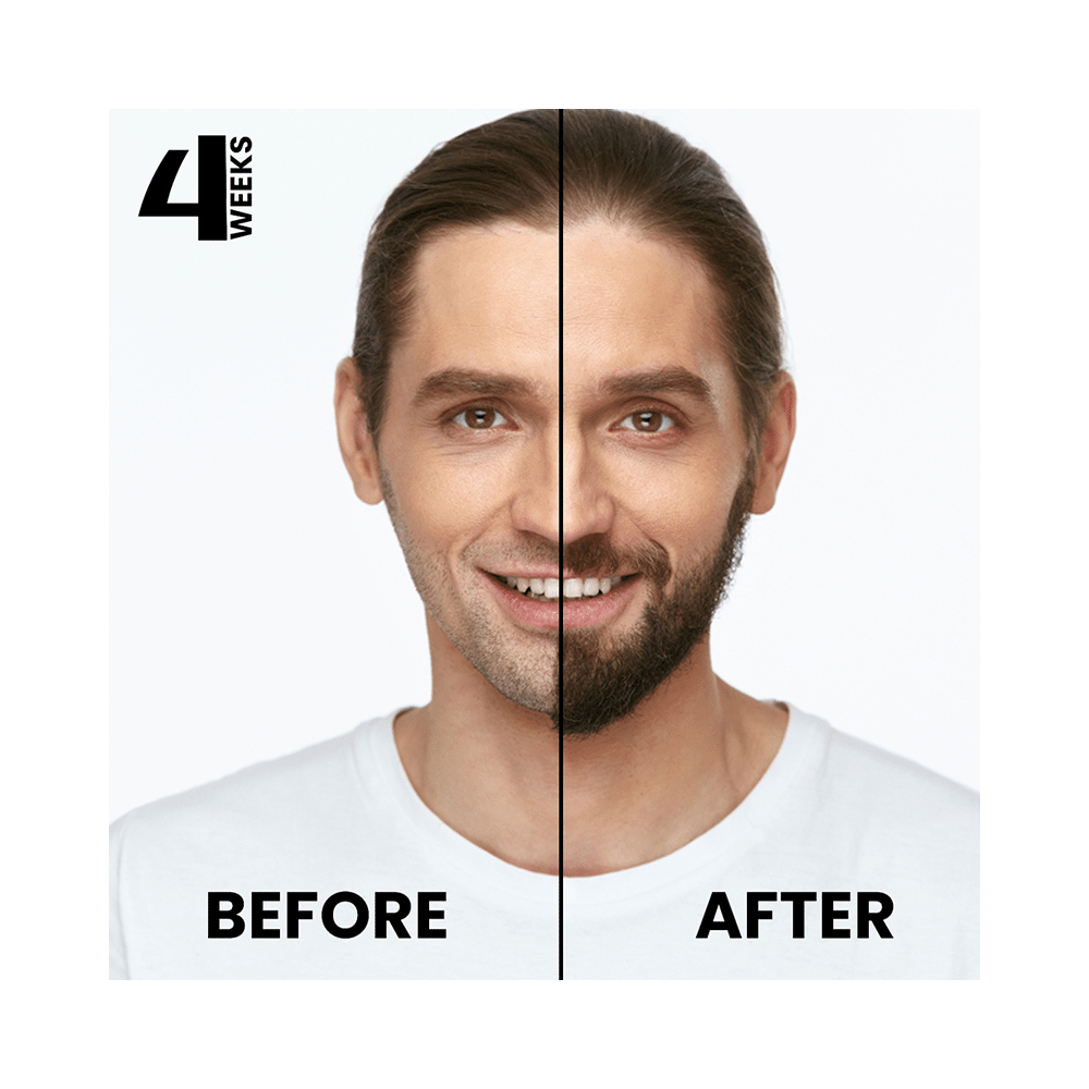 Wolbecie Beard Growth Oil - Image 5