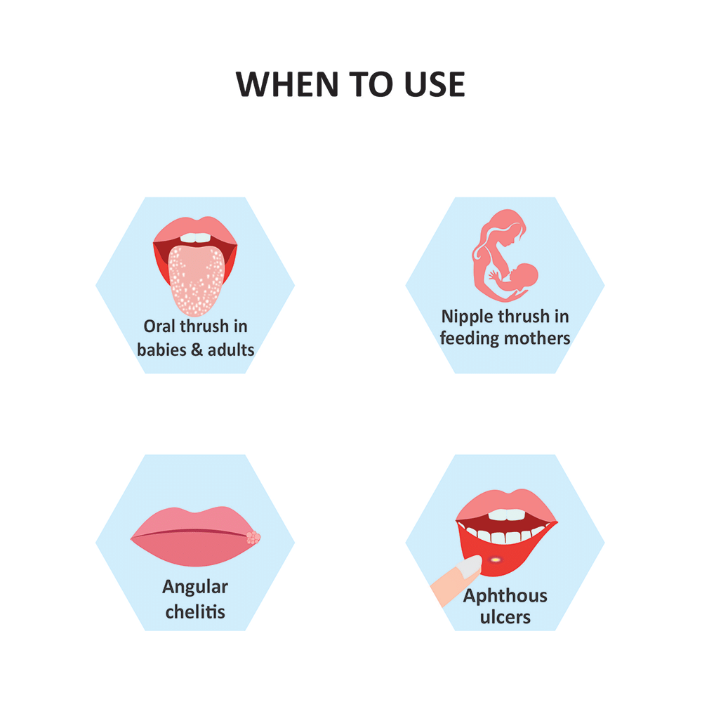 Stoma Care-OT Mouth Paint - Image 4