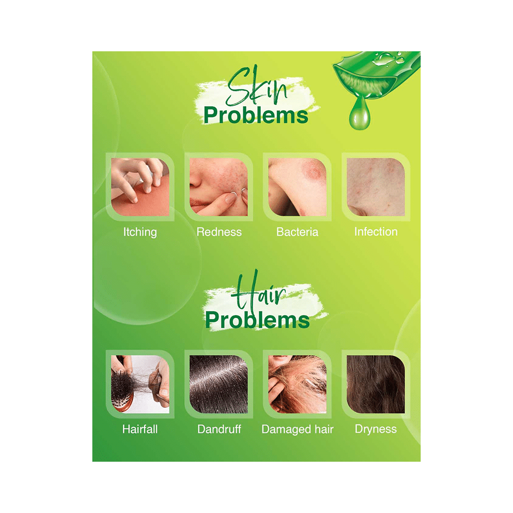 Spantra Aloe Tea Tree Gel - Image 4