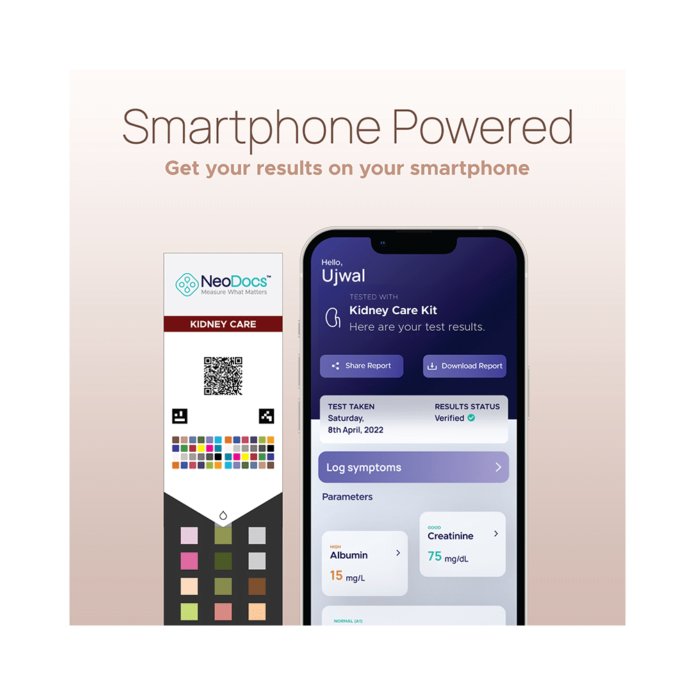 NeoDocs Kidney Care Urine Test Kit - Image 4