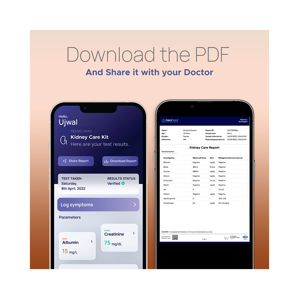 NeoDocs Kidney Care Urine Test Kit - Image 6