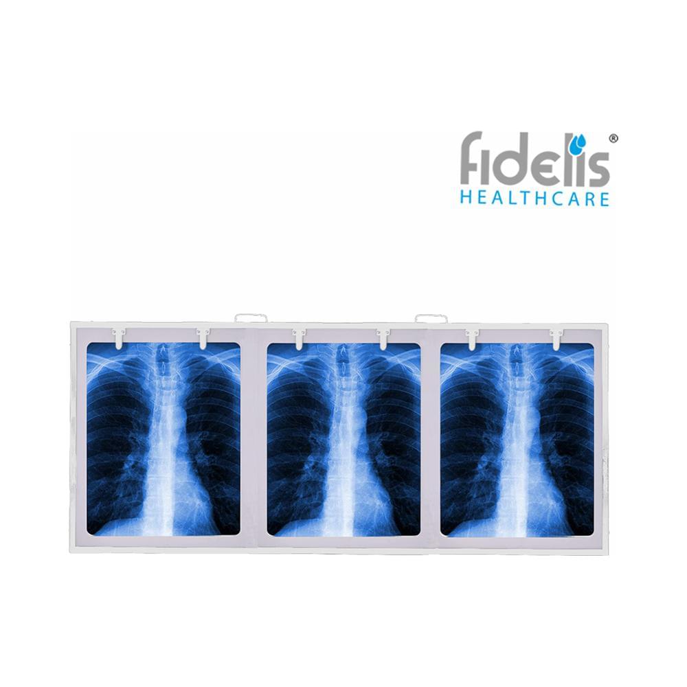 Fidelis X'ray View Box 18inch x 42inch White Triple