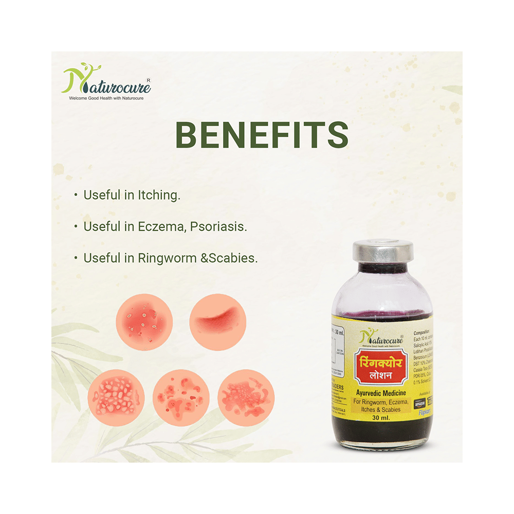 Naturocure RingCURE Lotion (30ml Each) - Image 4