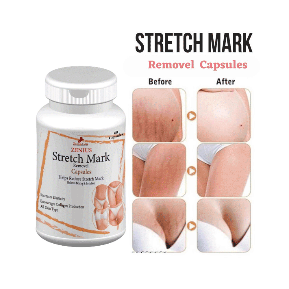 Zenius Stretch Mark Removal Capsule for Stretch Marks | Scar Removal | Uneven Skin Tone | All Skin Types - Image 4
