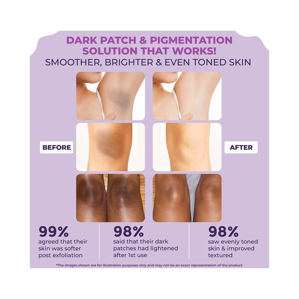 Sanfe Glycoclear Dark Patch Removal Wipe-Off Cream - Image 6