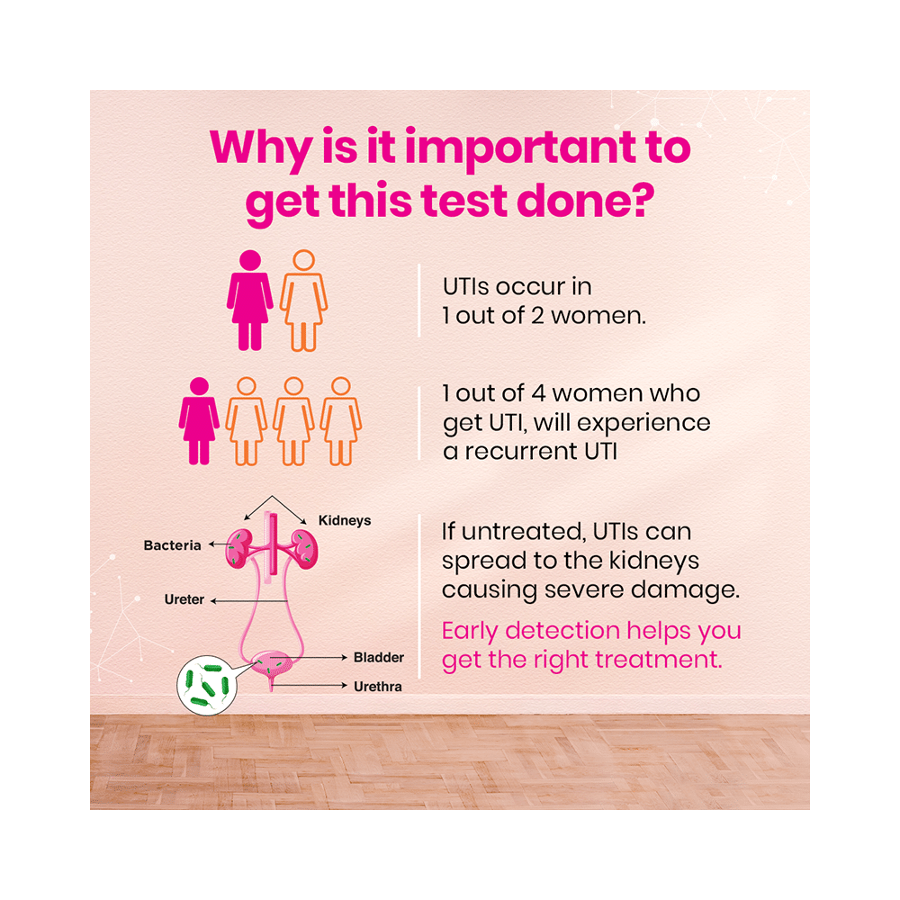 i-Know UTI Testing Kit - Image 6