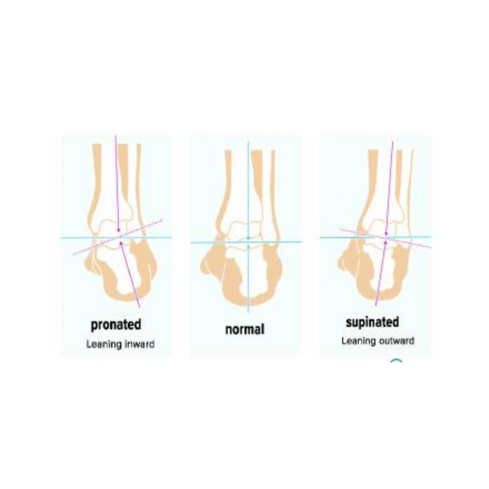 Limitless Elite Arch Support Insole Size 42 - Image 8