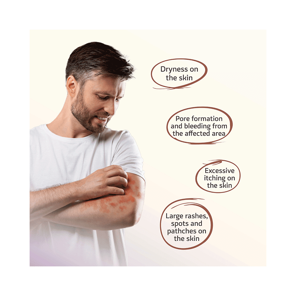 Swaarnim Ayurevda Psoriasis Care Capsule (120 Each) - Image 5