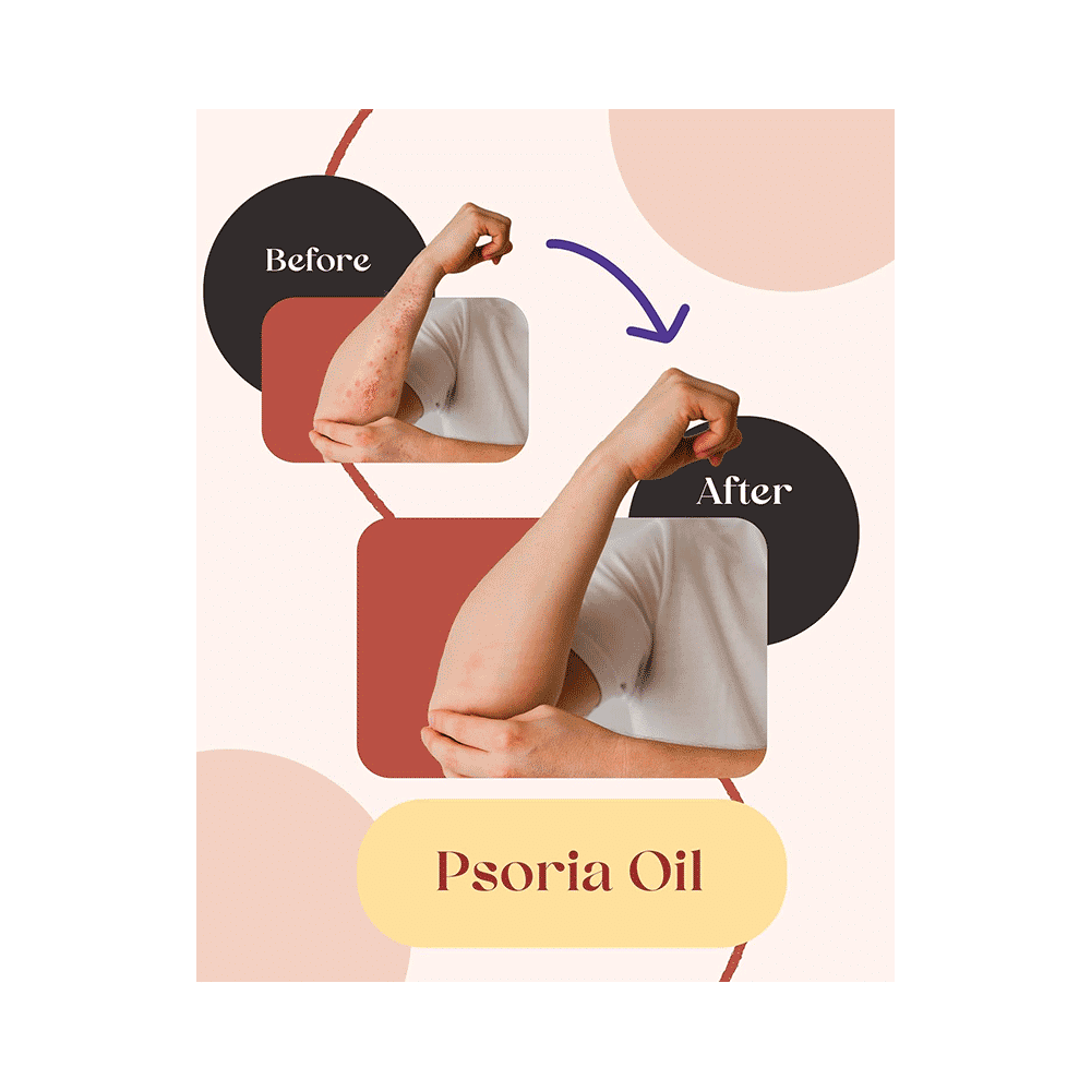 Siya Ayurveda Psoria Oil - Image 6