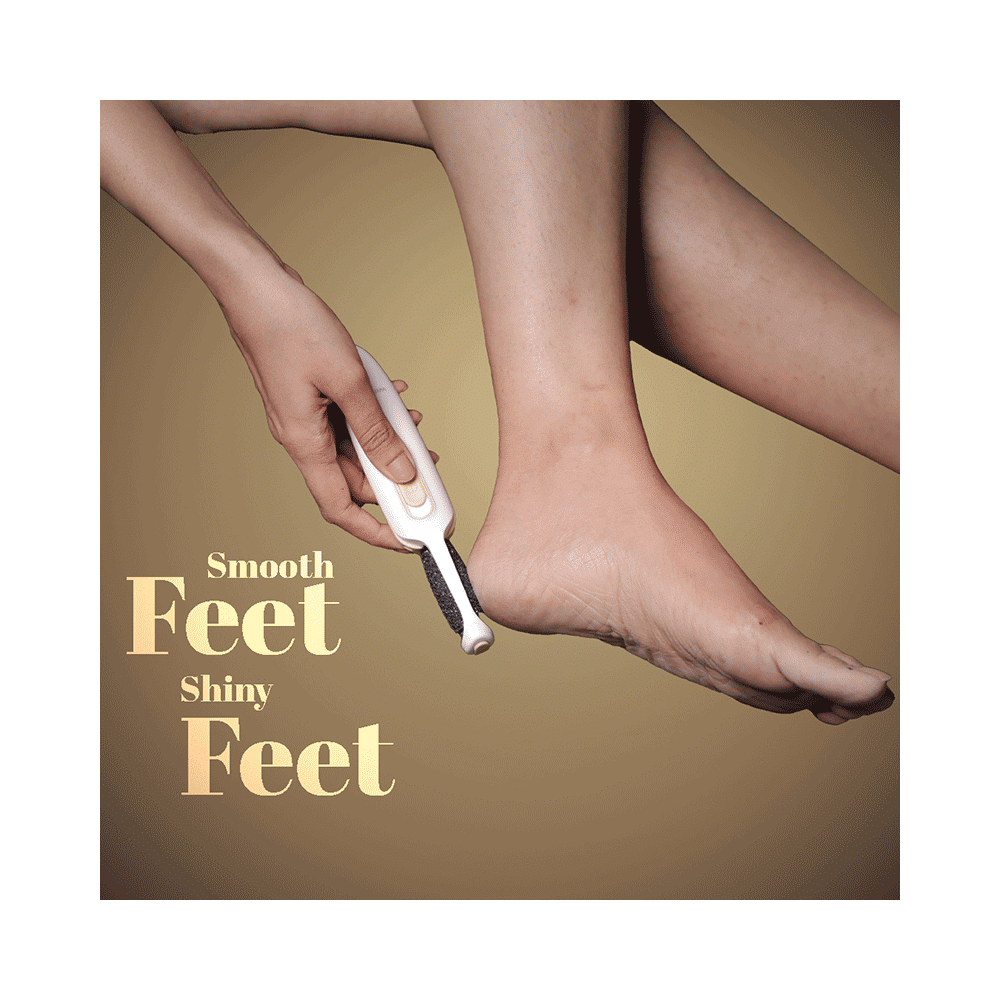 Winston Callus Remover - Image 2