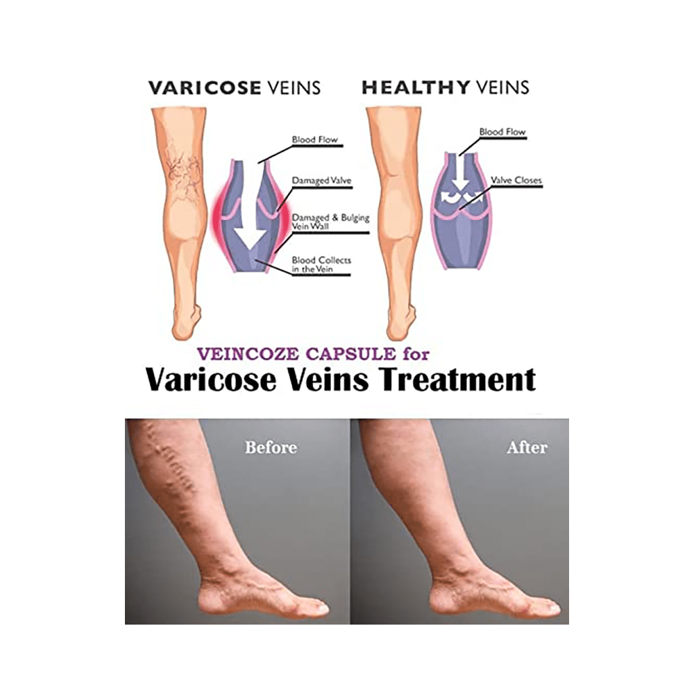 Veincoze Advanced Formula Capsule for Varicose Veins and Spider Veins Support (20 Each) - Image 5