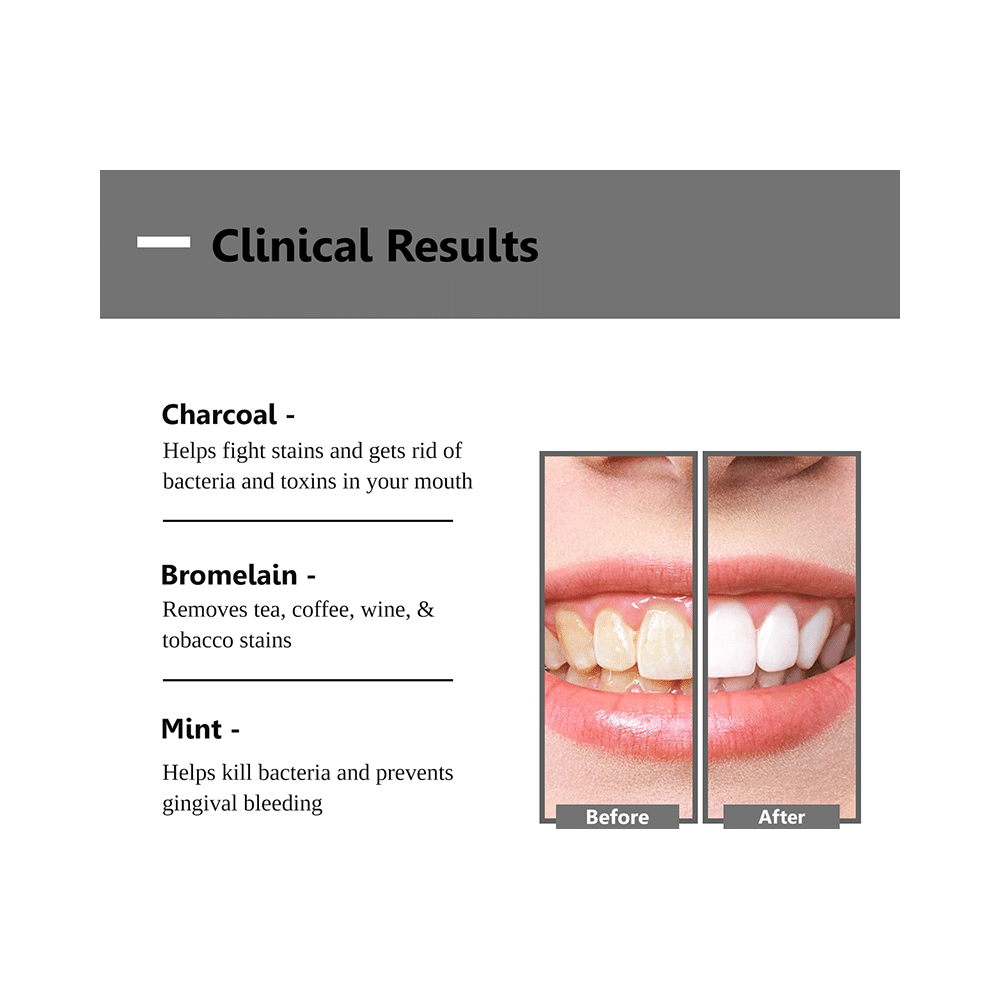 Oralvit Activated Charcoal Teeth Whitening Powder - Image 3