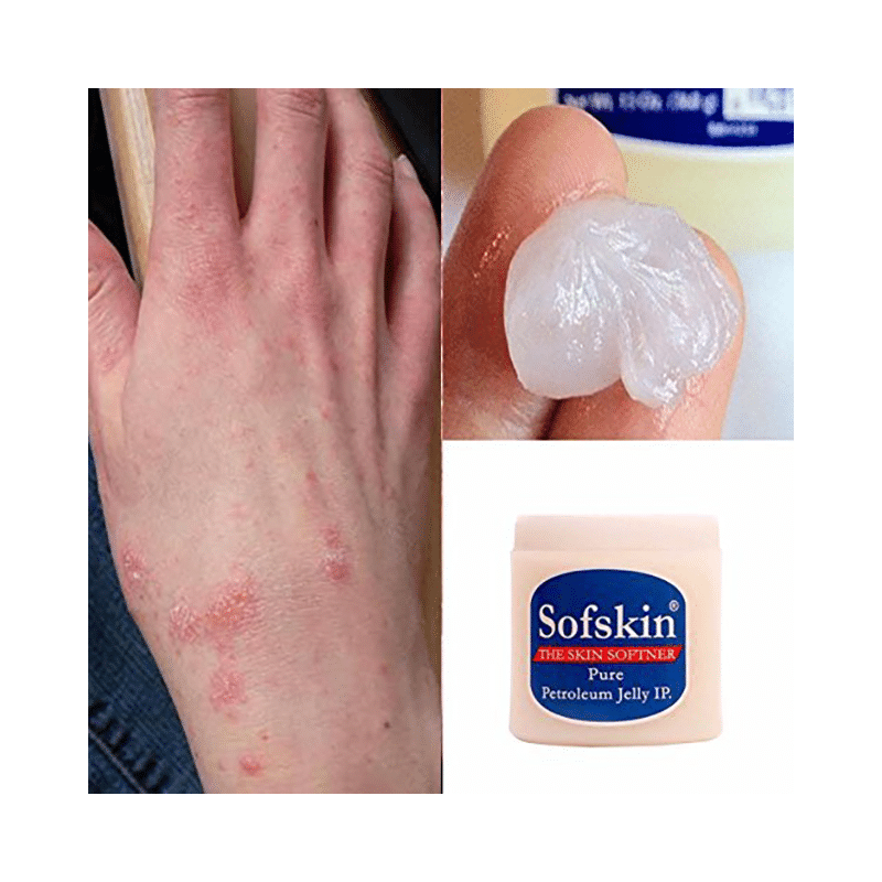 Sofskin White Petroleum Jelly - Image 5