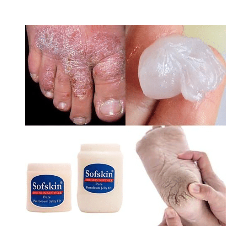 Sofskin White Petroleum Jelly - Image 3