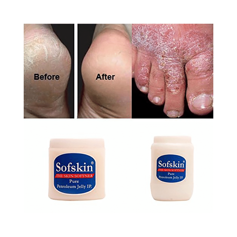 Sofskin White Petroleum Jelly - Image 4