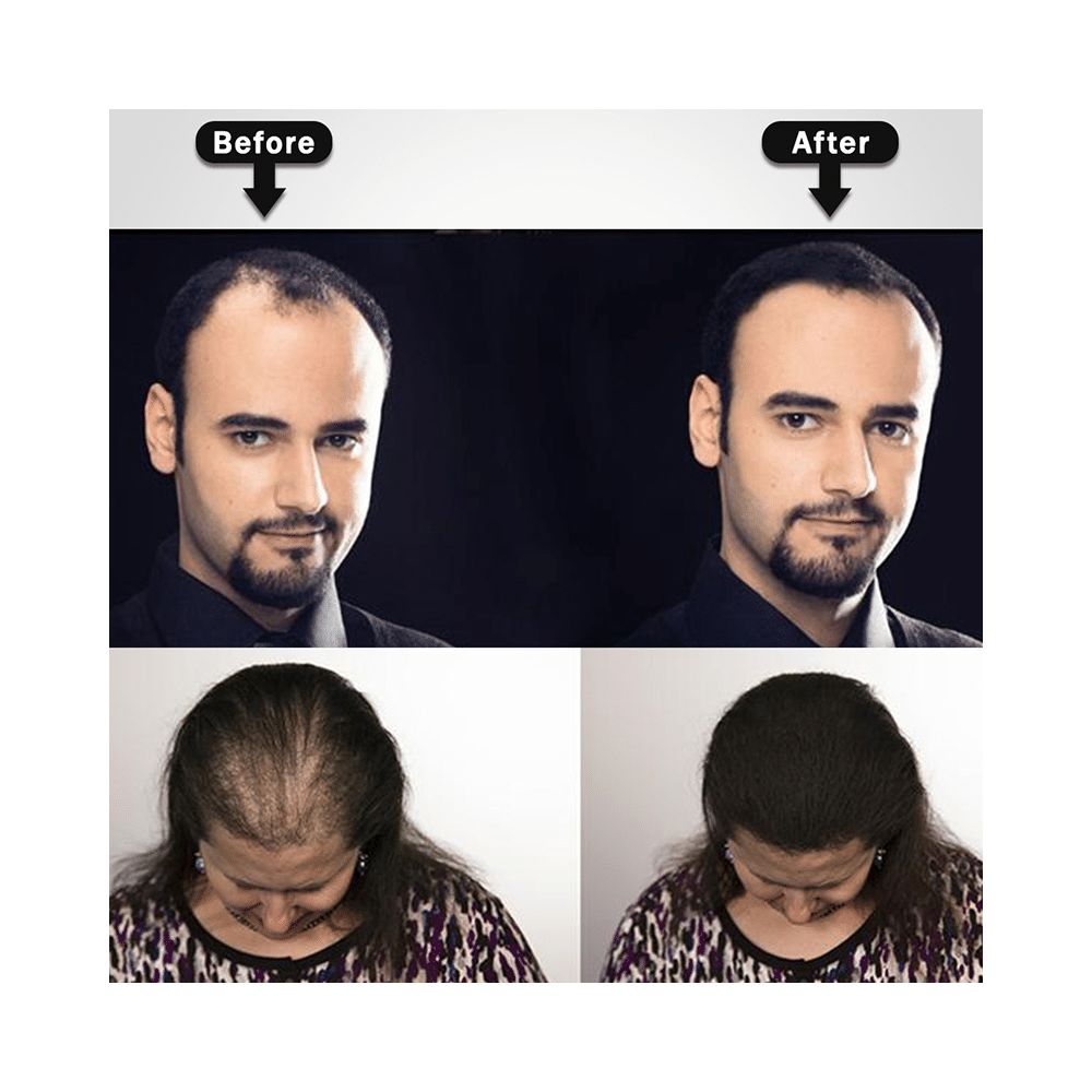 Keya Seth Instant Hair Building Fibers Hair Loss Concealer Powder Black - Image 5