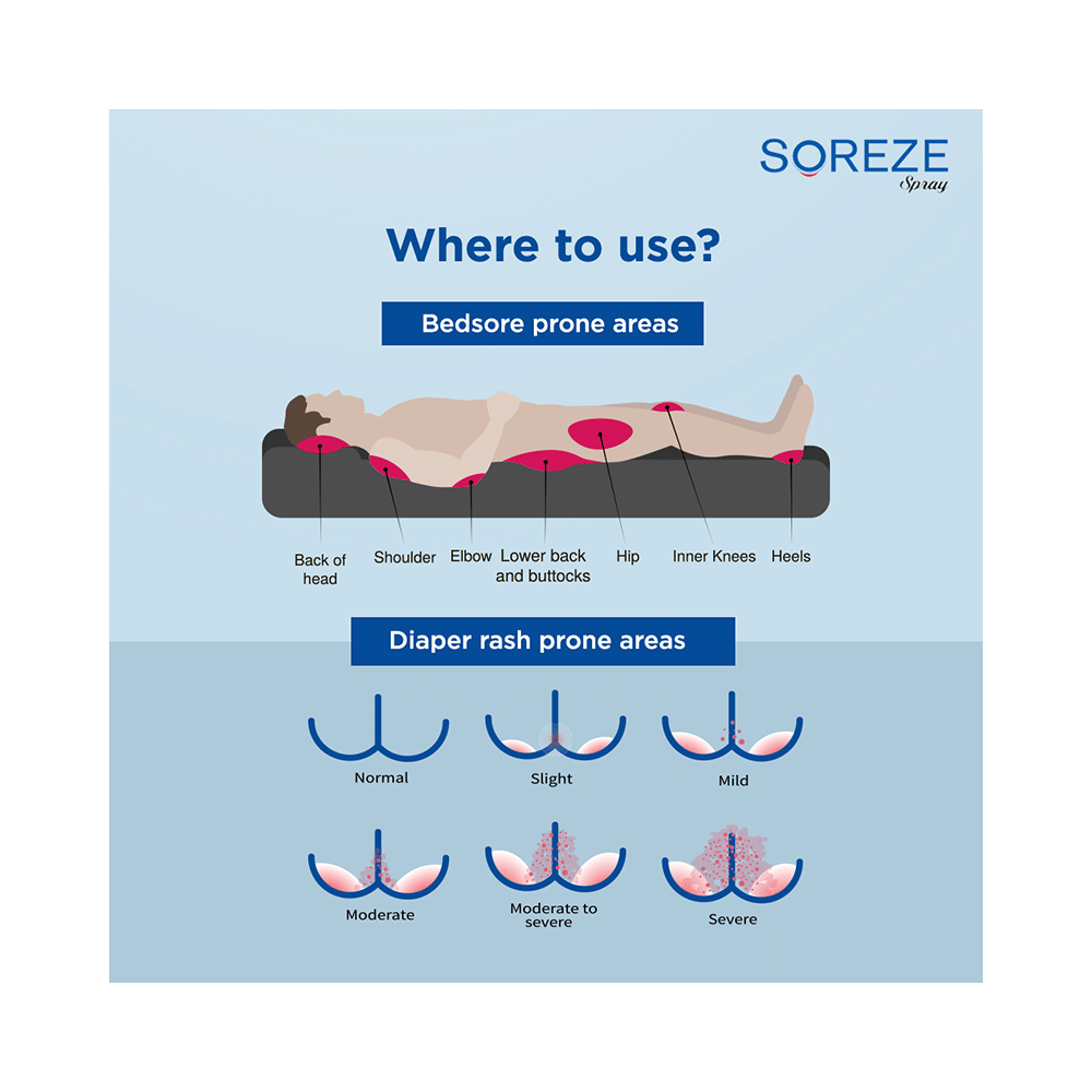 Soreze Spray (50ml Each) - Image 8