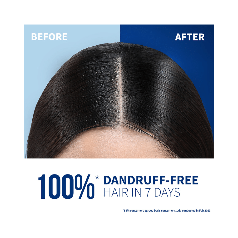 St.Botanica Anti-Dandruff Pre-Biotic  Shampoo - Image 5