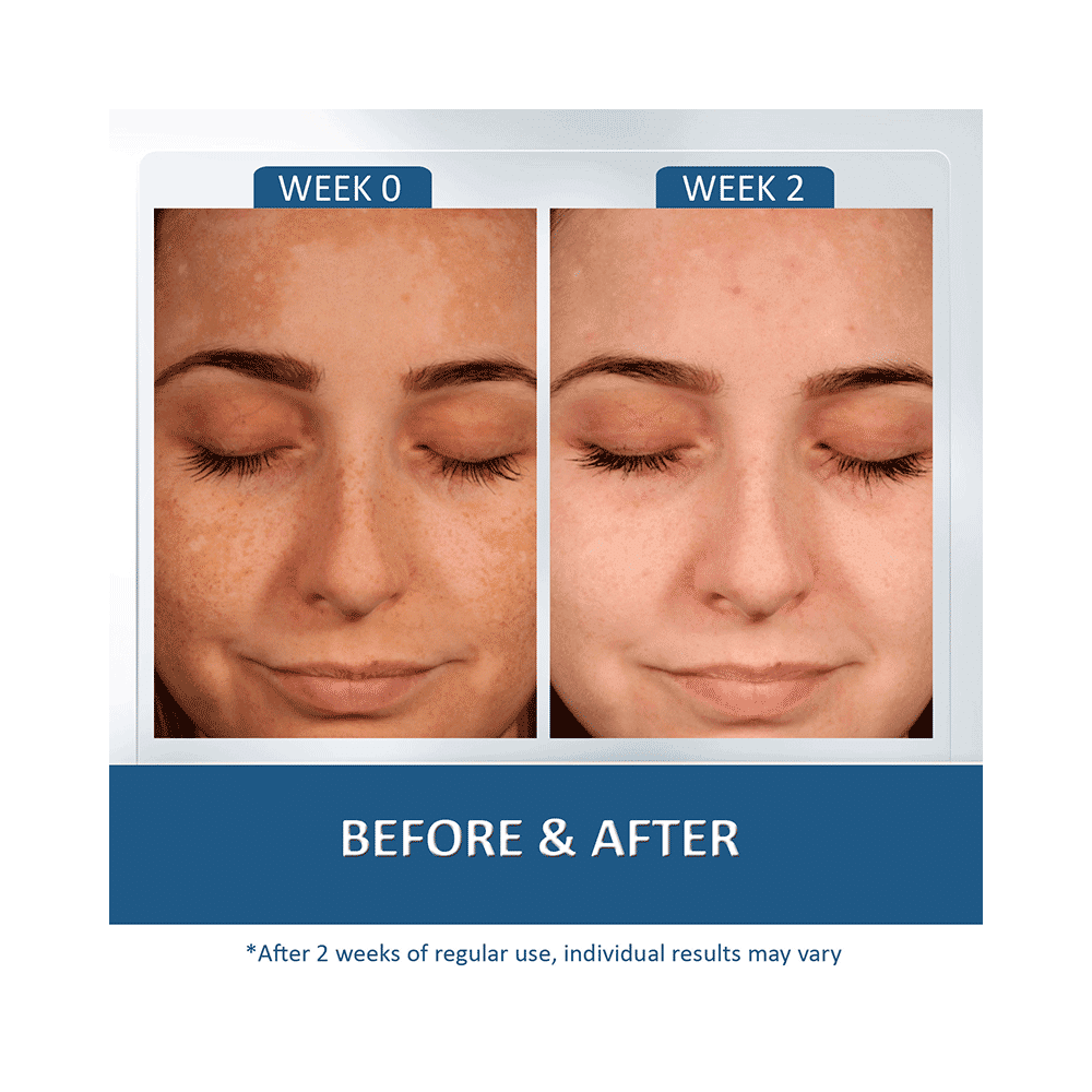 7Days Goodbye Blemishes and Pigmentation Cream - Image 9