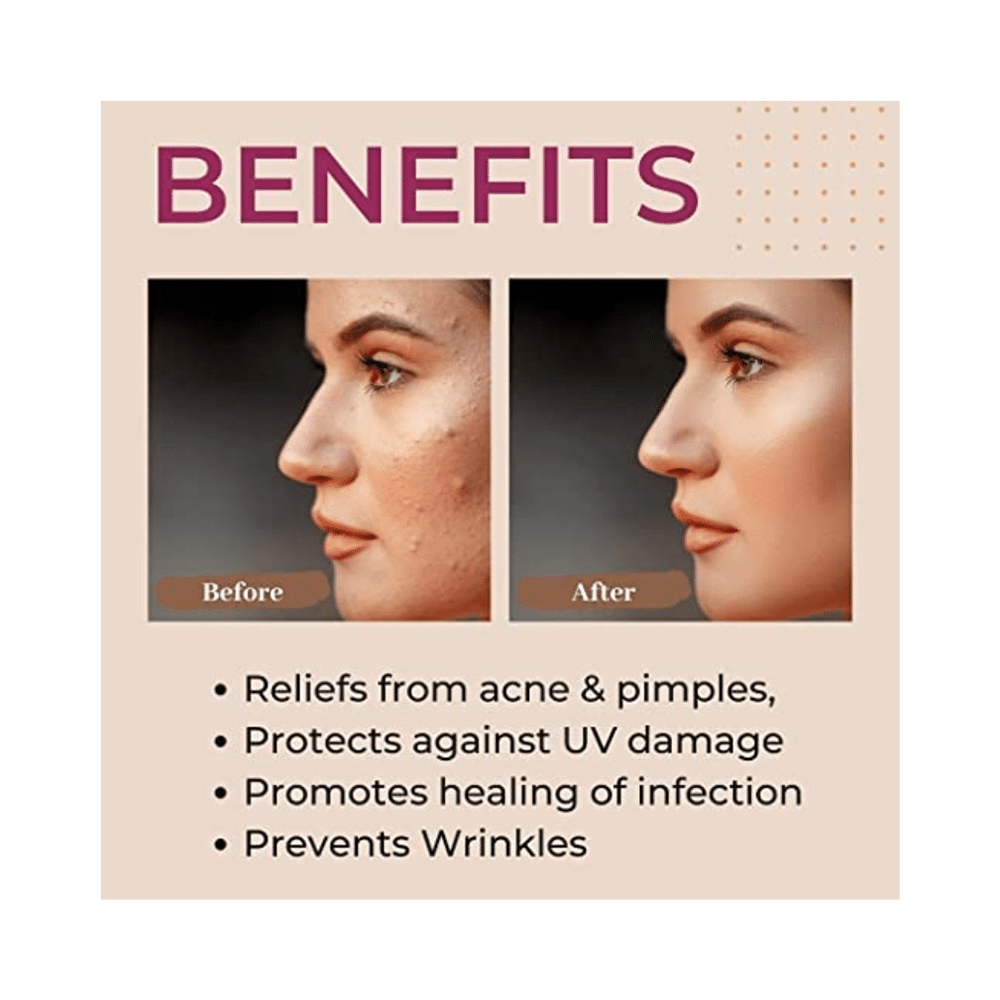 Biolife Acknil Anti Acne & Pimple Cream (25gm Each) - Image 5