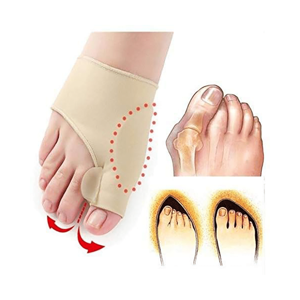 Skudgear Bunion Correction Toe Separator with Support - Image 2