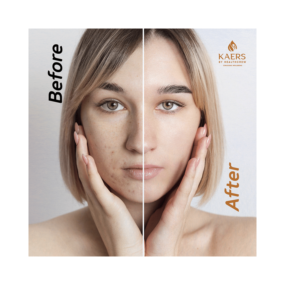 Kaers By Healthcrew Black Seed & Hyaluronic Face Serum - Image 5