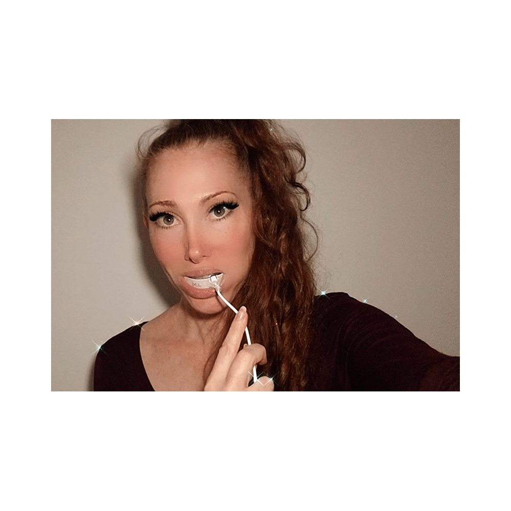 Vein Check Dental Teeth Whitening Device-Red LED - Image 5