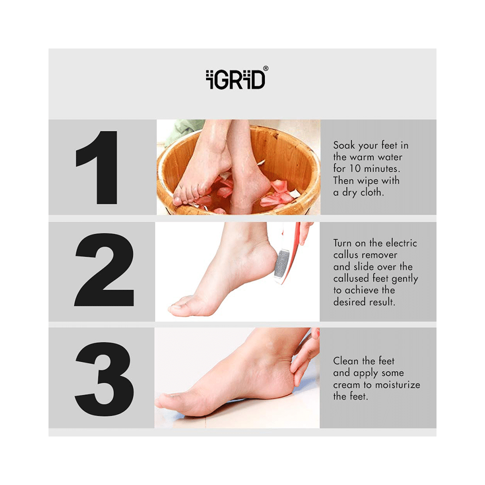 iGRiD IG 1089 Rechargeable Pedicure Device for Callus & Dead Skin Remover - Image 2