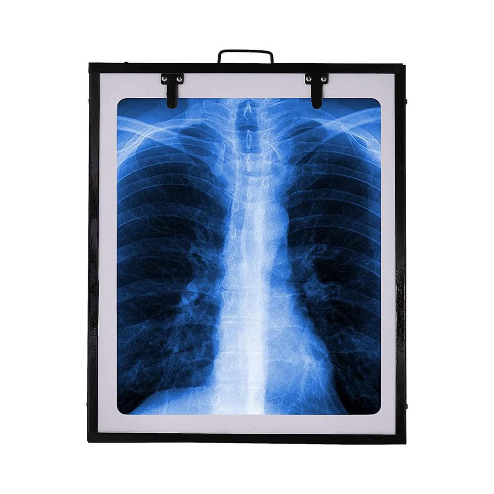 Fidelis X'ray View Box 14inch x 17inch Black Single - Image 1