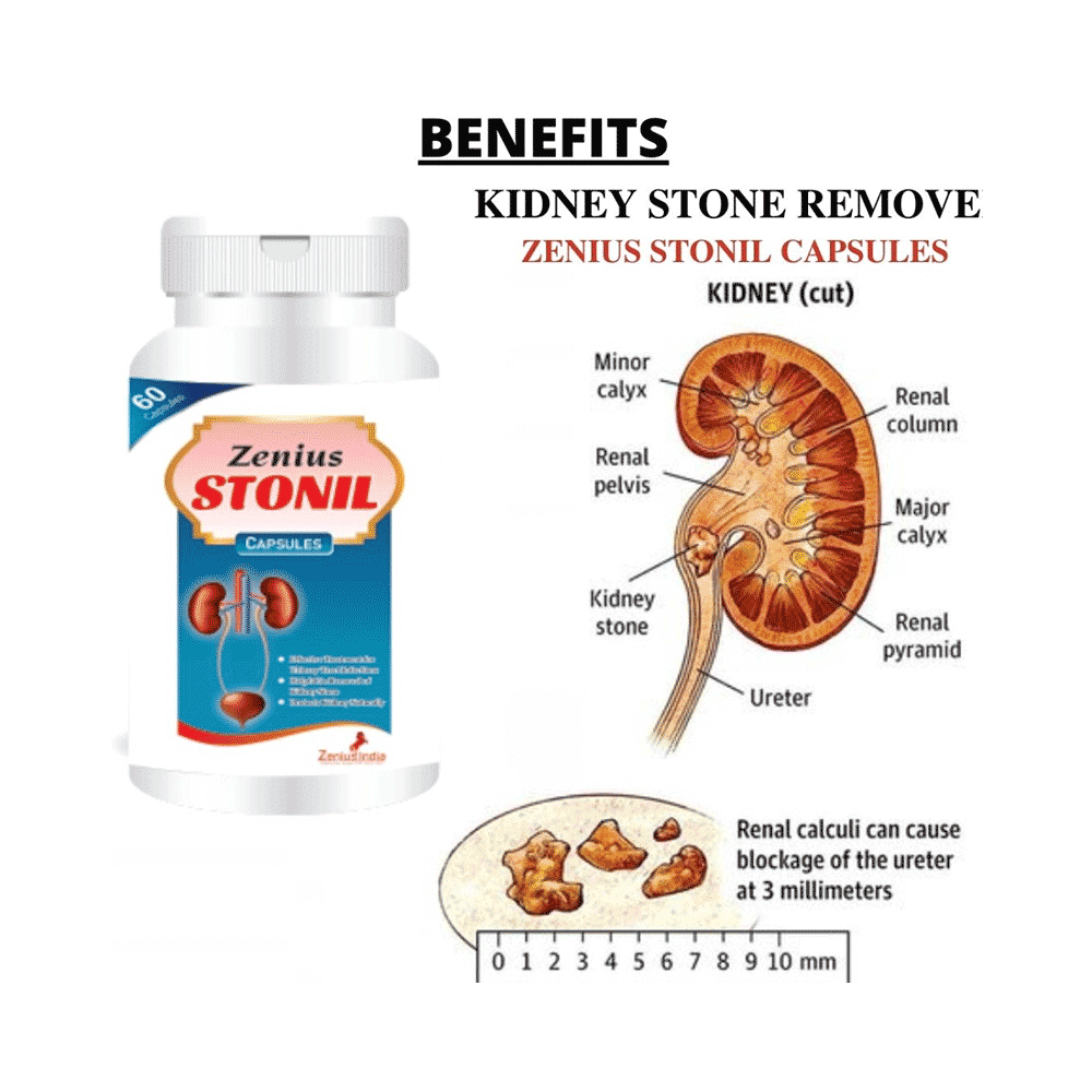 Zenius Stonil Capsule for Kidney Stone Removal - Image 5