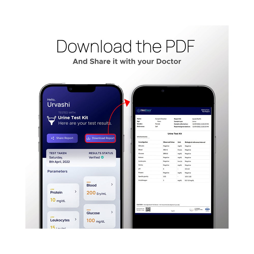 NeoDocs Advanced- Instant Urine Test Kit - Image 5