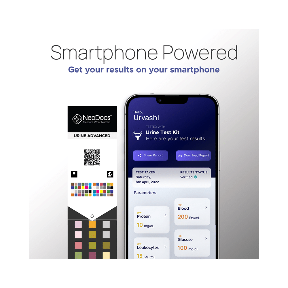 NeoDocs Advanced- Instant Urine Test Kit - Image 3